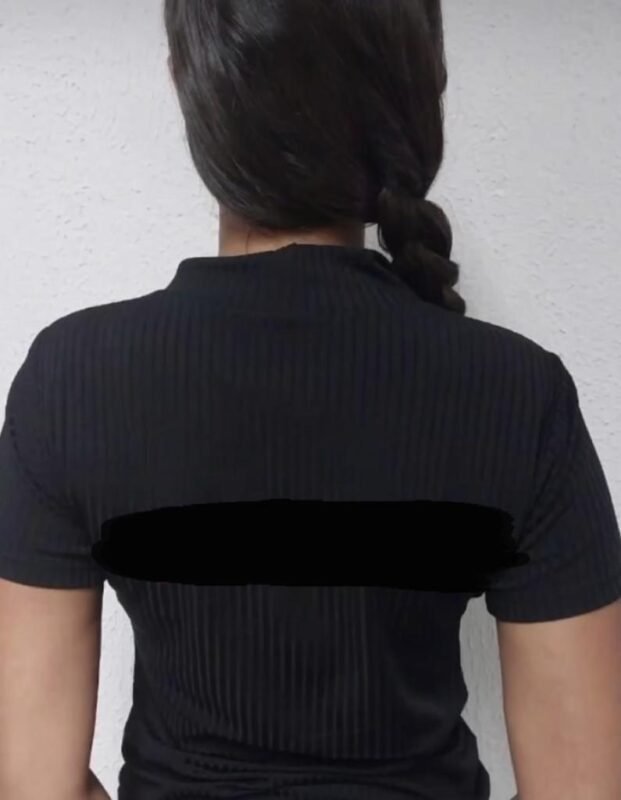 mulher-presa-envenenamento-621x800-1