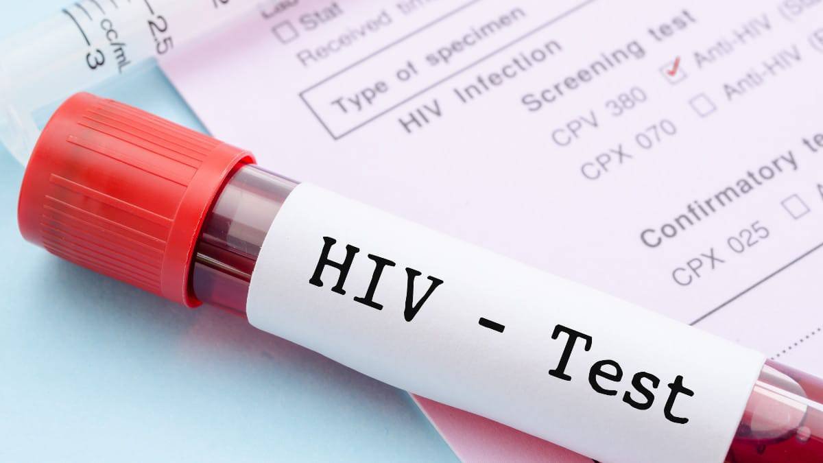 HIV-capa